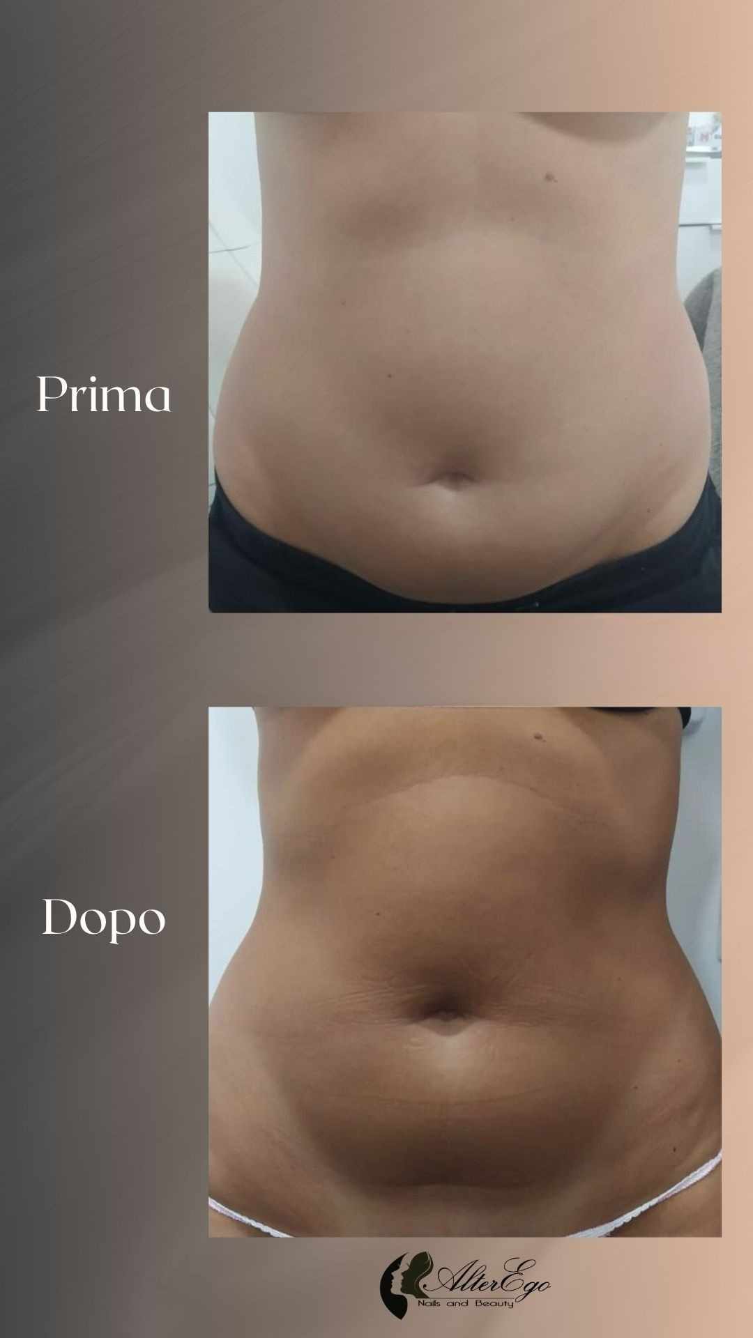Risultati corpo_centro estetico_roma 