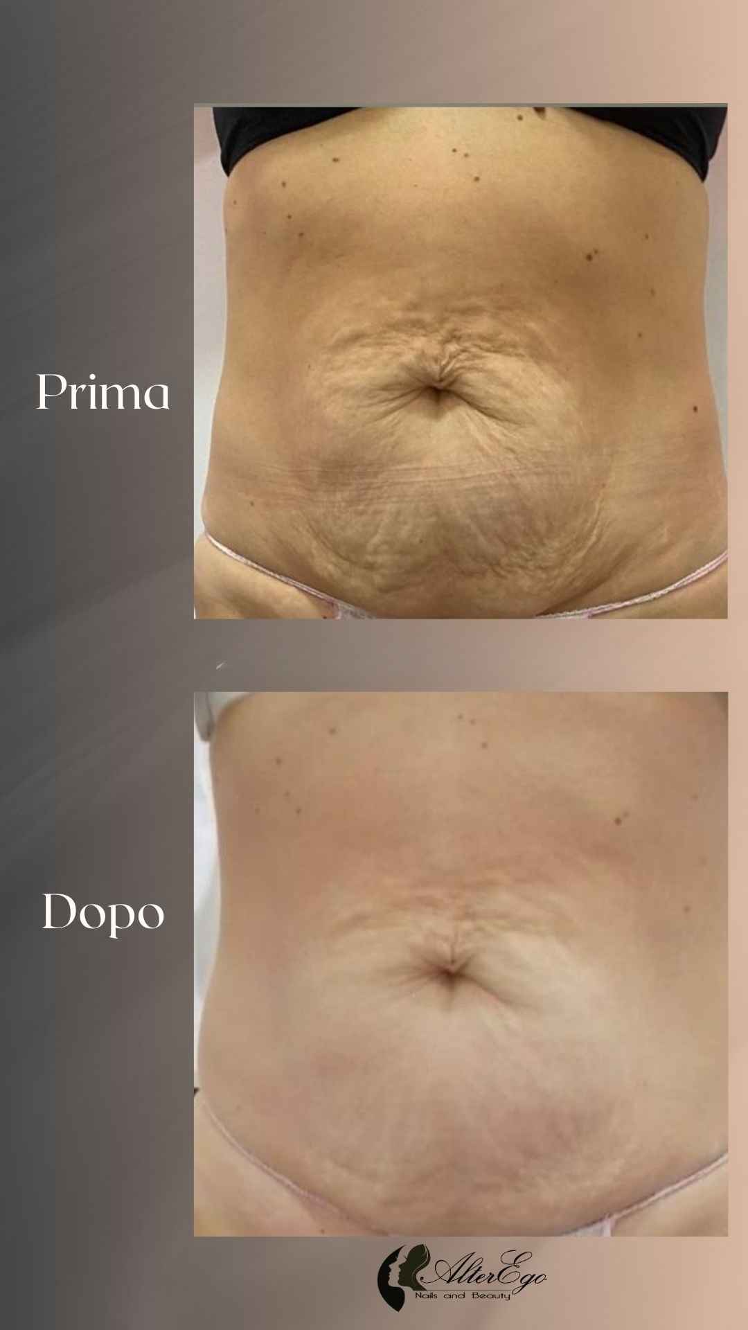 Risultati corpo_centro estetico_roma 