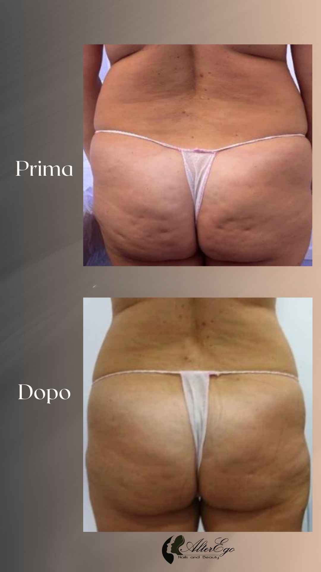 Risultati corpo_centro estetico_roma 